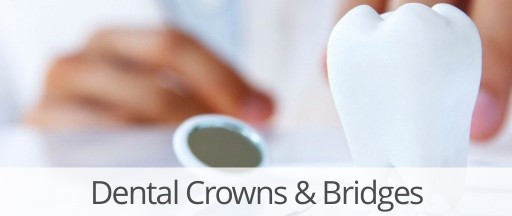 dental-crowns-bridges